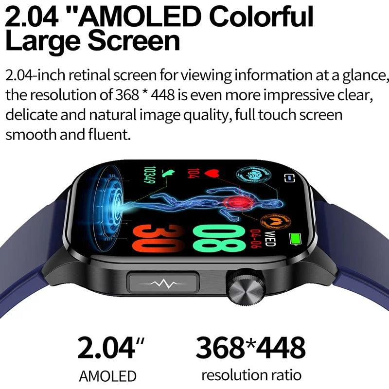 Smartwatch ET580 Men Health Monitoring Electronic Smart watches  Women Voice Assistant Sports Fitness Tracker Bracelet 2024