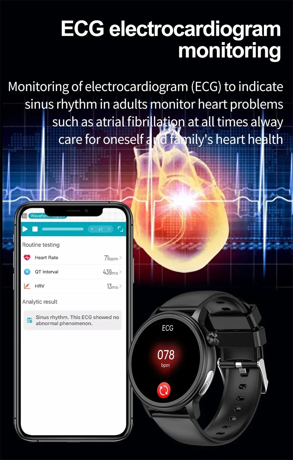 For Xiaomi Bluetooth Call Smartwatch for men women ECG+PPG+HRV Health Watch Blood Sugar Lipid Uric Acid Sport Smart Watches 2024