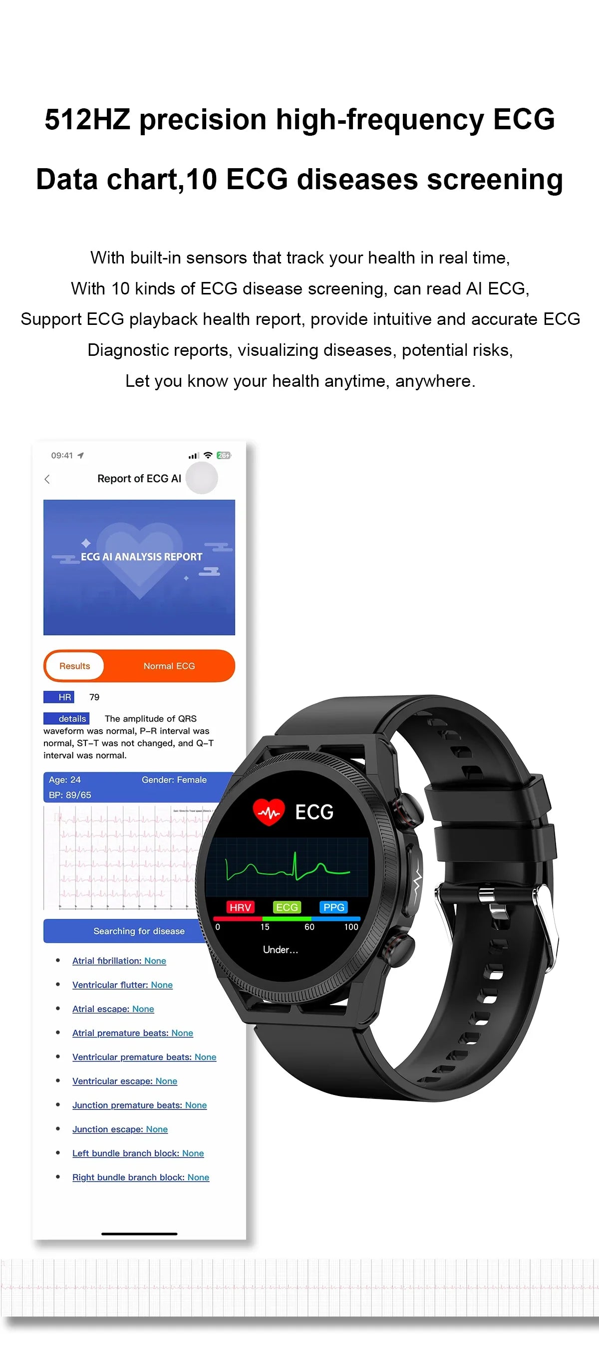 2024 New ECG+PPG AI Medical Diagnosis Uric Acid Non invasive Blood Glucose Smart Watch Men Bluetooth Call Blood Lipid Smartwatch