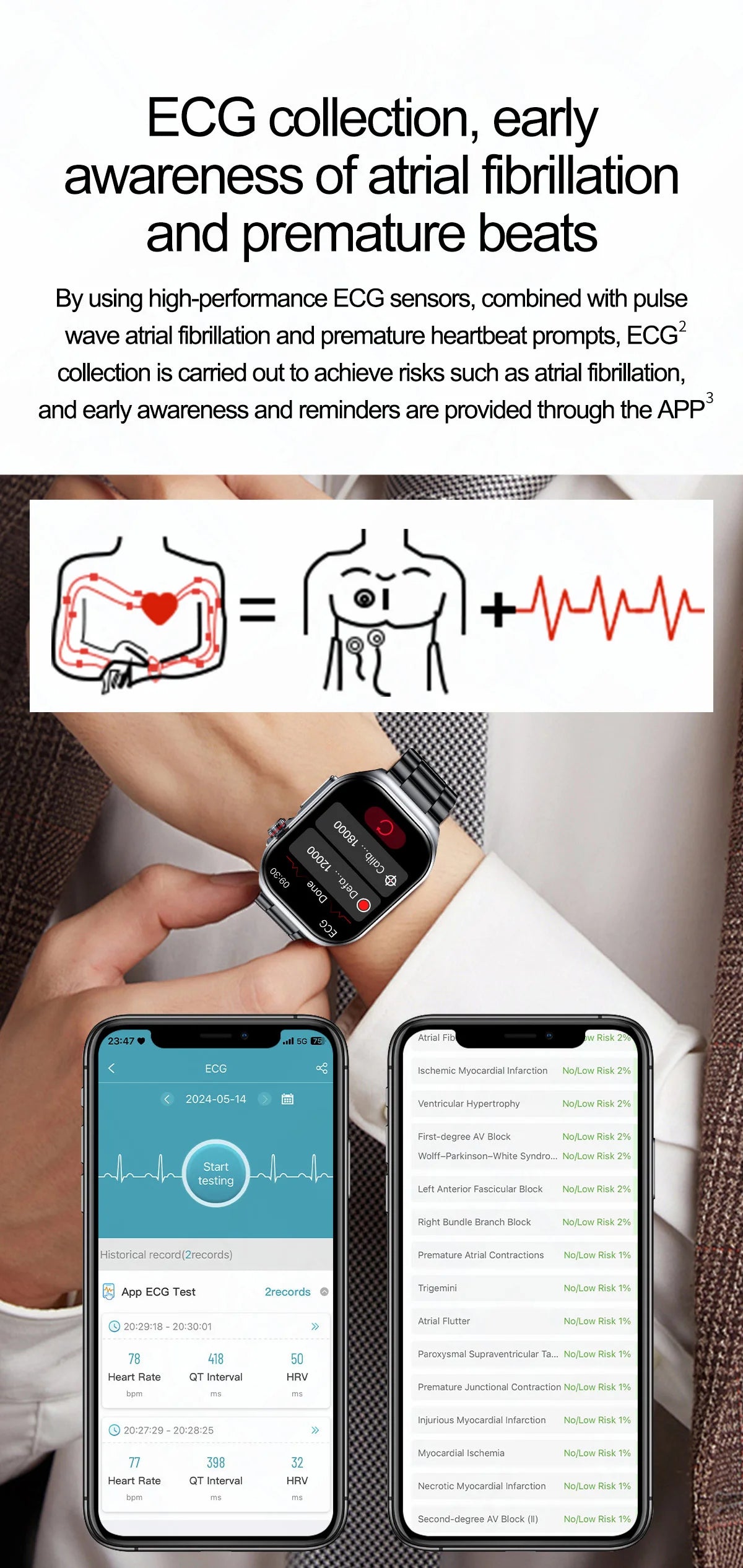 2024 New Medical Grade Smart Watch Men Blood Sugar Lipids Uric Acid Watches ECG AI Voice Health Clock Bluetooth Call  Smartwatch